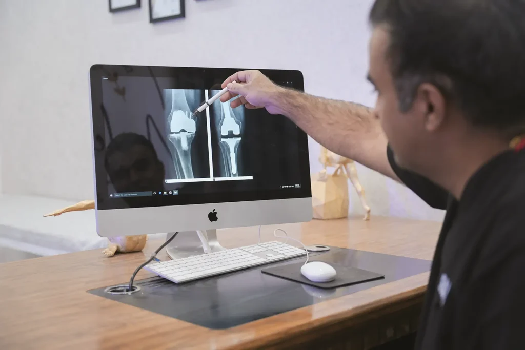 عفونت بعد از جراحی تعویض مفصل زانو 